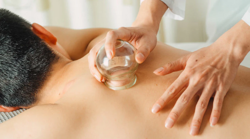What's the deal with cupping?